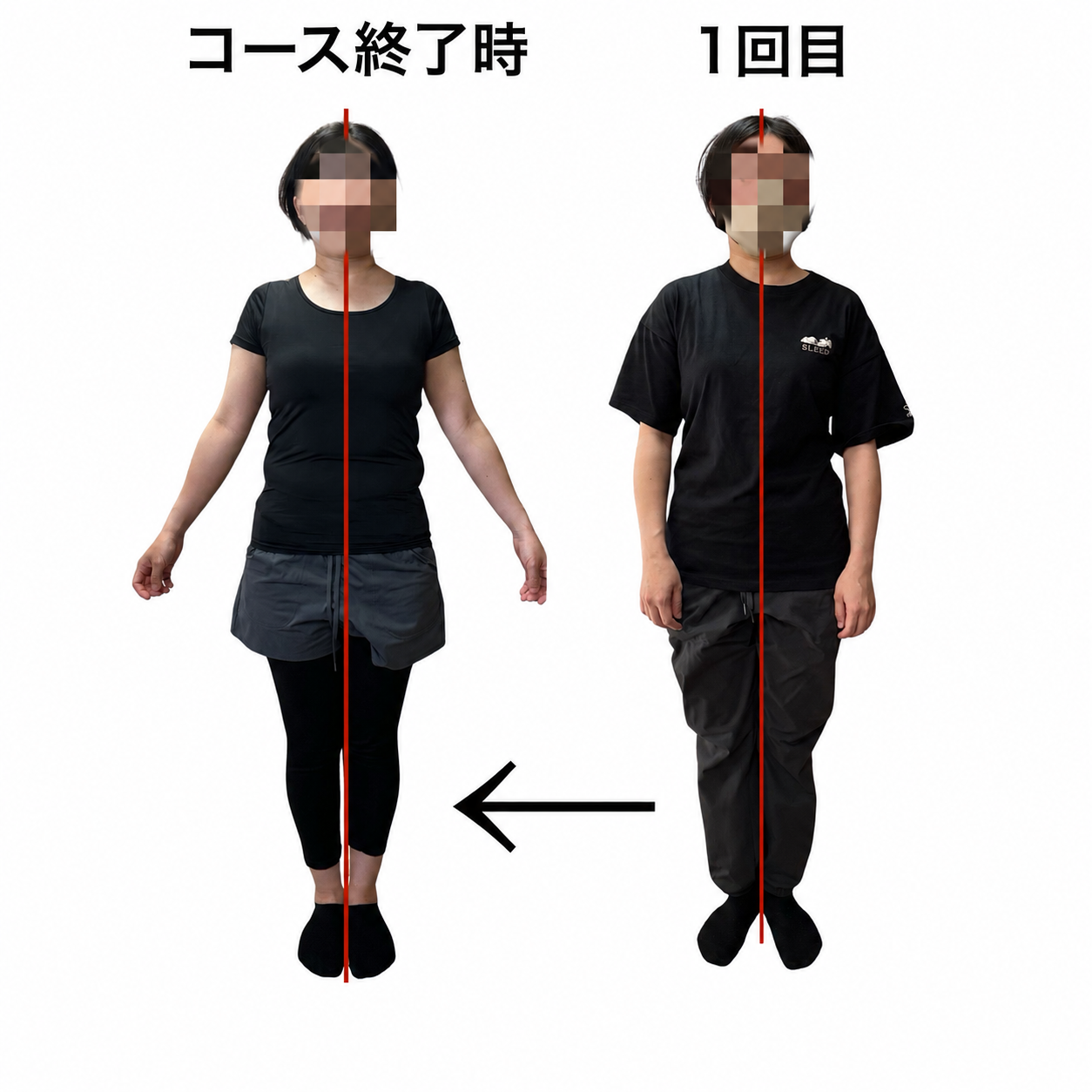 姿勢のビフォーアフター CASE 05 正面