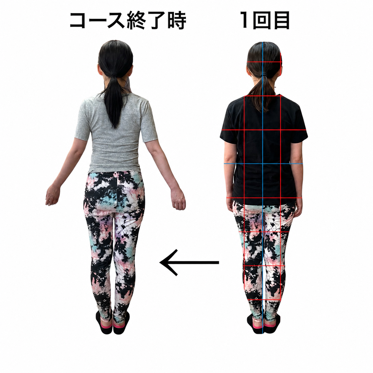 姿勢のビフォーアフター CASE 04 背面